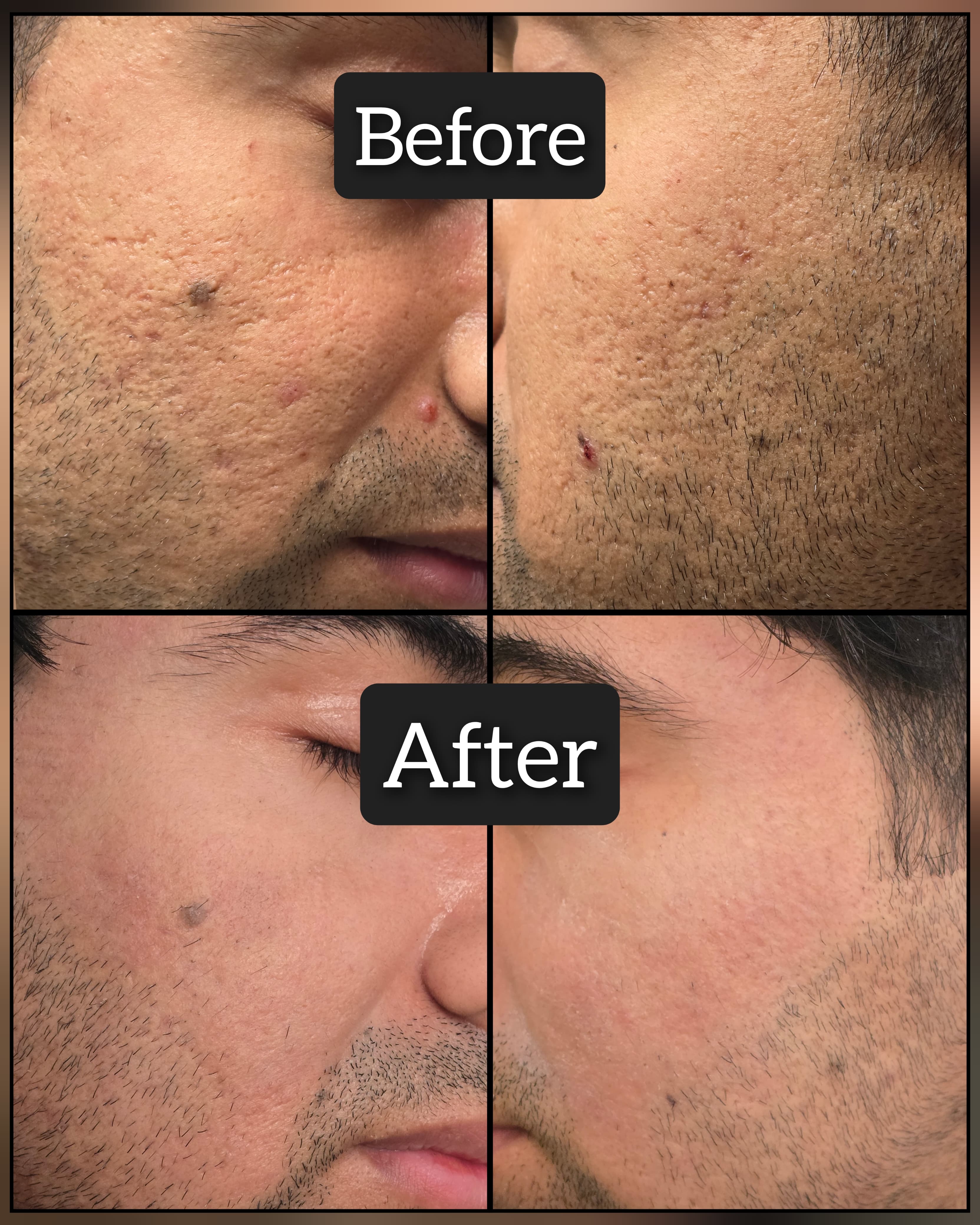 Client 1 - glowing skin