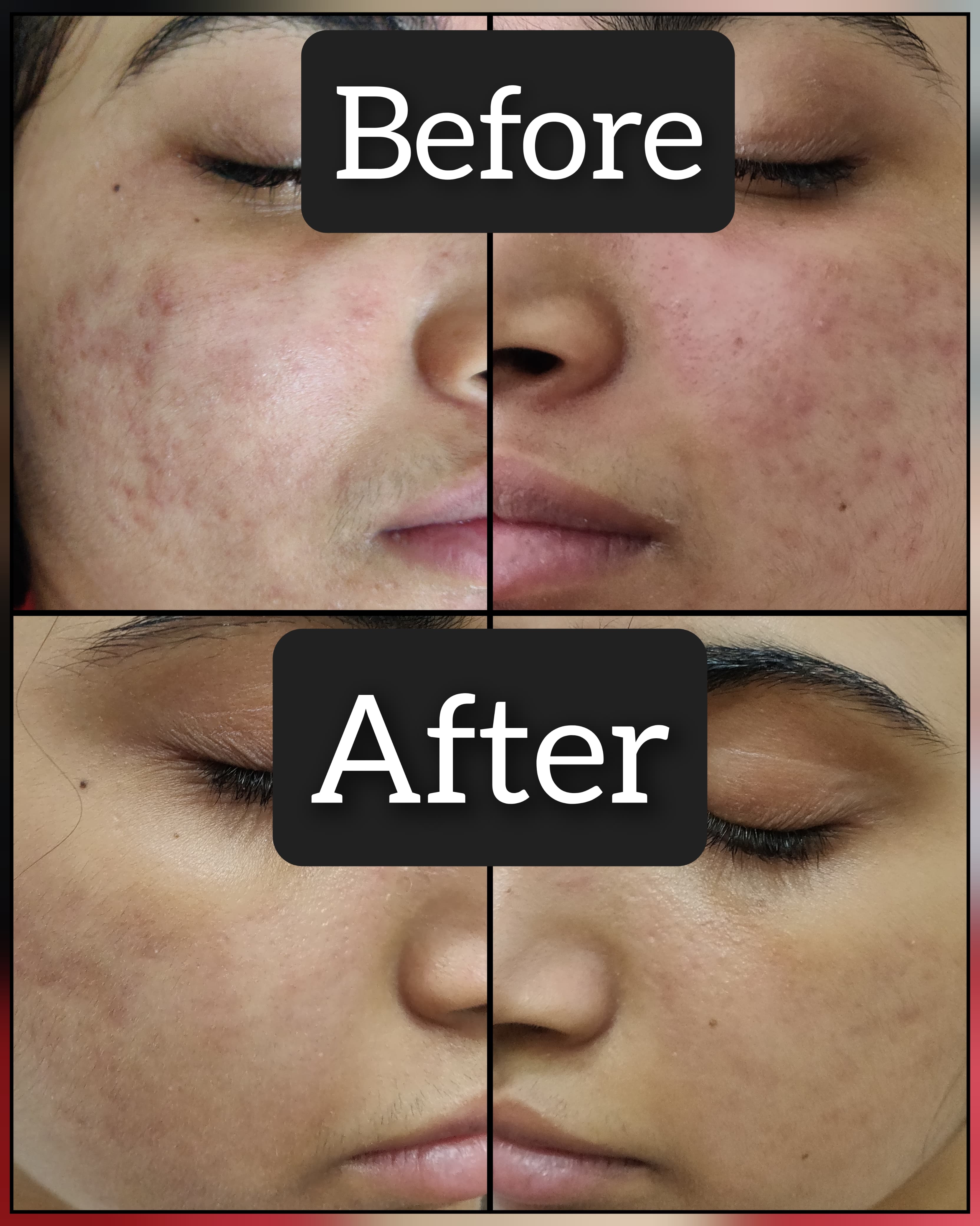 Client 2 - professional care